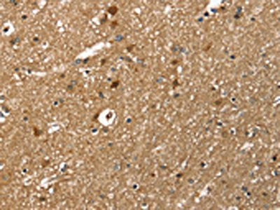 The image on the left is immunohistochemistry of paraffin-embedded Human brain  tissue using TWF1 Antibody(TWF1 Antibody) at dilution 1/30, on the right is treated with fusion protein. (Original magnification: ×200)Rabbit anti-Human TWF1 Polyclonal Antibody