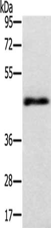 Gel: 8%SDS-PAGE, Lysate: 40 μg, Lane: Lovo cells, Primary antibody: TWF1 Antibody(TWF1 Antibody) at dilution 1/400, Secondary antibody: Goat anti rabbit IgG at 1/8000 dilution, Exposure time: 2 minutesRabbit anti-Human TWF1 Polyclonal Antibody