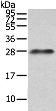 Gel: 12%SDS-PAGE, Lysate: 40 μg, Lane: Human plasma solution, Primary antibody: IGLV1-51 Antibody(Lambda Light chain Antibody) at dilution 1/200 dilution, Secondary antibody: Goat anti rabbit IgG at 1/8000 dilution, Exposure time: 10 secondsRabbit anti-Human IGLV1-51 Polyclonal Antibody
