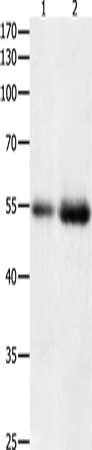 Gel: 10%SDS-PAGE, Lysate: 40 μg, Lane 1-2: Human colon tissue, Human kidney cancer tissue, Primary antibody: HDAC1 Antibody(HDAC1 Antibody) at dilution 1/400, Secondary antibody: Goat anti rabbit IgG at 1/8000 dilution, Exposure time: 2 minutesRabbit anti-Human HDAC1 Polyclonal Antibody