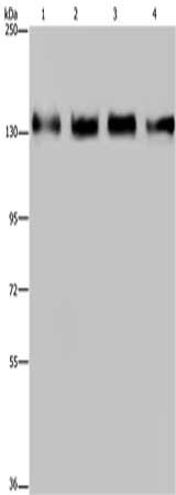 Gel: 6%SDS-PAGE, Lysate: 40 μg, Lane 1-4: 293T cells, Hela cells, A172 cells, A549 cells, Primary antibody: GOLGA2 Antibody(GOLGA2 Antibody) at dilution 1/300, Secondary antibody: Goat anti rabbit IgG at 1/8000 dilution, Exposure time: 10 secondsRabbit anti-Human GOLGA2 Polyclonal Antibody