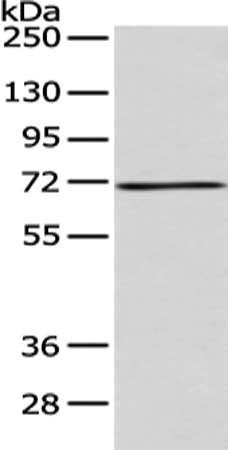 Gel: 8%SDS-PAGE, Lysate: 40 μg, Lane: 293T cell, Primary antibody: ACSM5 Antibody(ACSM5 Antibody) at dilution 1/200 dilution, Secondary antibody: Goat anti rabbit IgG at 1/8000 dilution, Exposure time: 30 seconds