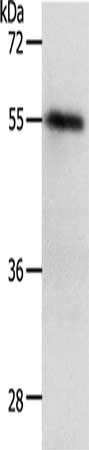 Gel: 12%SDS-PAGE, Lysate: 30 μg, Lane: K562 cells, Primary antibody: RAD52 Antibody(RAD52 Antibody) at dilution 1/450, Secondary antibody: Goat anti rabbit IgG at 1/8000 dilution, Exposure time: 1 minuteRabbit anti-Human RAD52 Polyclonal Antibody