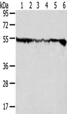 Gel: 8%SDS-PAGE,Lysate: 40 μg,Lane 1-6: Hela cells, HepG2 cells, Jurkat cells, 231 cells, SKOV3 cells, 293T cells,Primary antibody: DDX39B Antibody(DDX39B Antibody) at dilution 1/200 dilution,Secondary antibody: Goat anti rabbit IgG at 1/8000 dilution,Exposure time: 1 secondRabbit anti-Human DDX39B Polyclonal Antibody