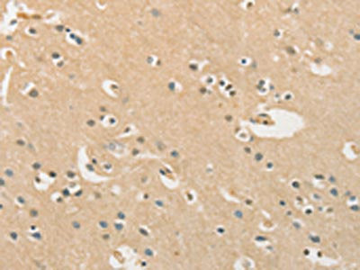 The image on the left is immunohistochemistry of paraffin-embedded Human brain  tissue using CHRNA2 Antibody(CHRNA2 Antibody) at dilution 1/40, on the right is treated with synthetic peptide. (Original magnification: ×200)Rabbit anti-Human CHRNA2 Polyclonal Antibody