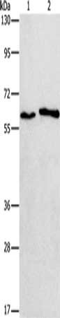Gel: 8%SDS-PAGE, Lysate: 40 μg, Lane 1-2: A172 cells, A549 cells, Primary antibody: CHRNA2 Antibody(CHRNA2 Antibody) at dilution 1/950, Secondary antibody: Goat anti rabbit IgG at 1/8000 dilution, Exposure time: 1 minuteRabbit anti-Human CHRNA2 Polyclonal Antibody