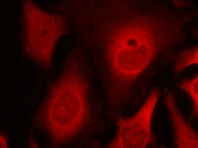 Immunofluorescence staining of methanol-fixed Hela cells using eIF2a(phospho-Ser49) Antibody.Rabbit anti-Human EIF2S1 Polyclonal Antibody