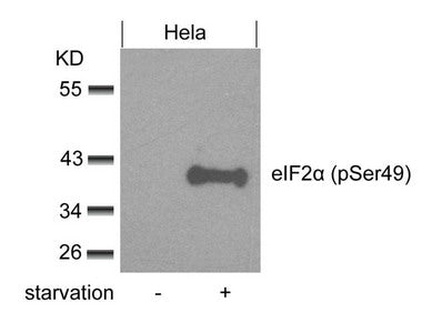 Western blot analysis of extracts from Hela cells untreated or treated with starvation using eIF2a(phospho-Ser49) Antibody.Rabbit anti-Human EIF2S1 Polyclonal Antibody