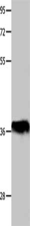 Gel: 10%SDS-PAGE, Lysate: 40 μg, Lane: Human lymphoma tissue, Primary antibody: POU2F2 Antibody(POU2F2 Antibody) at dilution 1/500, Secondary antibody: Goat anti rabbit IgG at 1/8000 dilution, Exposure time: 1 hour
