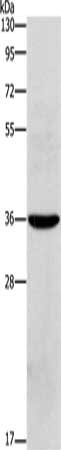 Gel: 10%SDS-PAGE, Lysate: 40 μg, Lane: Human placenta tissue, Primary antibody: OLR1 Antibody(OLR1 Antibody) at dilution 1/450, Secondary antibody: Goat anti rabbit IgG at 1/8000 dilution, Exposure time: 20 secondsRabbit anti-Human OLR1 Polyclonal Antibody