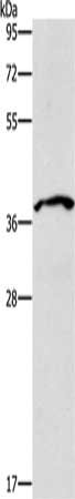 Gel: 10%SDS-PAGE, Lysate: 40 μg, Lane: Human chromaffin cell tumor tissue, Primary antibody: B3GAT1 Antibody(B3GAT1 Antibody) at dilution 1/600, Secondary antibody: Goat anti rabbit IgG at 1/8000 dilution, Exposure time: 3 minutes