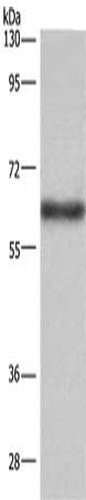 Gel: 6%SDS-PAGE, Lysate: 40 μg, Lane: Mouse liver tissue, Primary antibody: SIGLEC5 Antibody(SIGLEC5 Antibody) at dilution 1/350, Secondary antibody: Goat anti rabbit IgG at 1/8000 dilution, Exposure time: 2minutesRabbit anti-Human SIGLEC5 Polyclonal Antibody