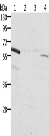 Gel: 10%SDS-PAGE, Lysate: 40 μg, Lane 1-4: Rat kidney tissue, human fetal kidney tissue, Jurkat cells, K562 cells, Primary antibody: ALDH6A1 Antibody(ALDH6A1 Antibody) at dilution 1/450, Secondary antibody: Goat anti rabbit IgG at 1/8000 dilution, Exposure time: 20 secondsRabbit anti-Human ALDH6A1 Polyclonal Antibody
