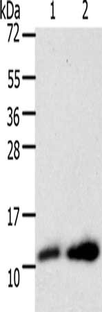 Gel: 12%SDS-PAGE, Lysate: 40 μg, Lane 1-2: A172 cells, hela cells, Primary antibody: TXN Antibody(TXN Antibody) at dilution 1/200, Secondary antibody: Goat anti rabbit IgG at 1/8000 dilution, Exposure time: 30 minutesRabbit anti-Human TXN Polyclonal Antibody