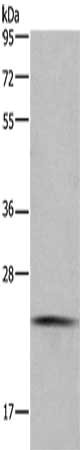 Gel: 10%SDS-PAGE, Lysate: 40 μg, Lane: Raji cells, Primary antibody: CMTM6 Antibody(CMTM6 Antibody) at dilution 1/200, Secondary antibody: Goat anti rabbit IgG at 1/8000 dilution, Exposure time: 1 minuteRabbit anti-Human CMTM6 Polyclonal Antibody