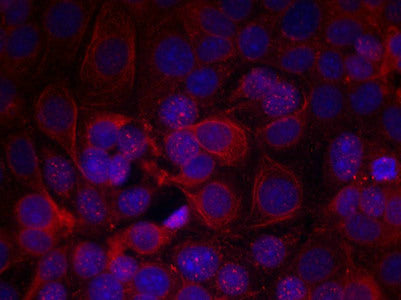 Immunofluorescence staining of methanol-fixed MCF cells using HER2(Phospho-Tyr1221/Tyr1222) Antibody.Rabbit anti-Human ERBB2 Polyclonal Antibody