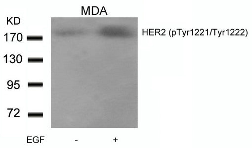 Western blot analysis of extracts from MDA cells untreated or treated with EGF using HER2(Phospho-Tyr1221/Tyr1222) Antibody.Rabbit anti-Human ERBB2 Polyclonal Antibody