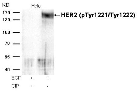 Western blot analysis of extracts from Hela cells, treated with EGF or calf intestinal phosphatase (CIP), using HER2 (Phospho-Tyr1221/Tyr1222) Antibody.Rabbit anti-Human ERBB2 Polyclonal Antibody
