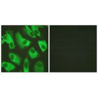 Immunofluorescence analysis of HeLa cells, using Kir5.1 (Ab-416) antibody.