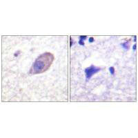 Immunohistochemistry analysis of paraffin-embedded human brain tissue using Kir5.1 (Ab-416) antibody.