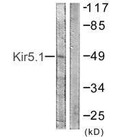 Western blot analysis of extracts from HeLa cells, using Kir5.1 (Ab-416) antibody.