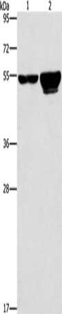 Gel: 6%SDS-PAGE, Lysate: 40 μg, Lane 1-2: 231 cells, A549 cells, Primary antibody: CDC25A Antibody(CDC25A Antibody) at dilution 1/300, Secondary antibody: Goat anti rabbit IgG at 1/8000 dilution, Exposure time: 20 secondsRabbit anti-Human CDC25A Polyclonal Antibody
