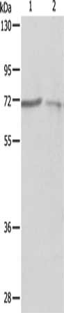 Gel: 10%SDS-PAGE, Lysate: 40 μg, Lane 1-2: A375 cells, A431 cells, Primary antibody: PTPN6 Antibody(PTPN6 Antibody) at dilution 1/500, Secondary antibody: Goat anti rabbit IgG at 1/8000 dilution, Exposure time: 90 secondsRabbit anti-Human PTPN6 Polyclonal Antibody
