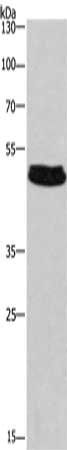 Gel: 8%SDS-PAGE, Lysate: 40 μg, Lane: Hela cells, Primary antibody: SEPT7 Antibody(SEPT7 Antibody) at dilution 1/430, Secondary antibody: Goat anti rabbit IgG at 1/8000 dilution, Exposure time: 30 secondsRabbit anti-Human SEPT7 Polyclonal Antibody
