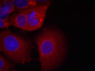 Immunofluorescence staining of methanol-fixed MCF7 cells using GSK3a(Ab-21) Antibody.Rabbit anti-Human GSK3A Polyclonal Antibody