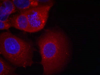 Immunofluorescence staining of methanol-fixed MCF7 cells using GSK3a(Ab-21) Antibody.Rabbit anti-Human GSK3A Polyclonal Antibody