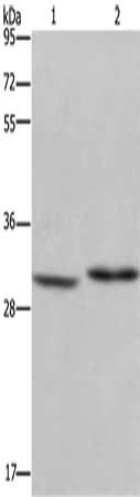 Gel: 10%SDS-PAGE, Lysate: 40 μg, Lane 1-2: Mouse liver tissue, A375 cells, Primary antibody: DHRS3 Antibody(DHRS3 Antibody) at dilution 1/550, Secondary antibody: Goat anti rabbit IgG at 1/8000 dilution, Exposure time: 20 secondsRabbit anti-Human DHRS3 Polyclonal Antibody