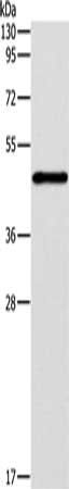 Gel: 10%SDS-PAGE, Lysate: 40 μg, Lane: Jurkat cells, Primary antibody: IRF3 Antibody(IRF3 Antibody) at dilution 1/260, Secondary antibody: Goat anti rabbit IgG at 1/8000 dilution, Exposure time: 10 seconds