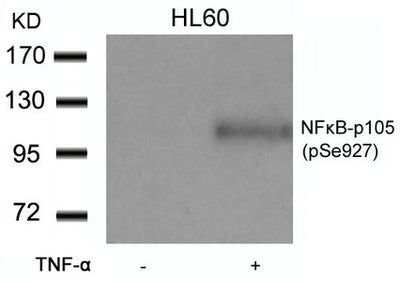 Western blot analysis of extracts from HL60 cells untreated or treated with TNF-a using NFkB-p105(Phospho-Ser927) Antibody.Rabbit anti-Human NFKB1 Polyclonal Antibody