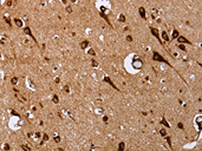 The image on the left is immunohistochemistry of paraffin-embedded Human brain  tissue using EPDR1 Antibody(EPDR1 Antibody) at dilution 1/20, on the right is treated with fusion protein. (Original magnification: ×200)Rabbit anti-Human EPDR1 Polyclonal Antibody