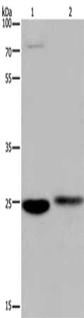 Gel: 8%SDS-PAGE, Lysate: 40 μg, Lane 1-2: Mouse brain tissue, human fetal muscle tissue, Primary antibody: EPDR1 Antibody(EPDR1 Antibody) at dilution 1/250, Secondary antibody: Goat anti rabbit IgG at 1/8000 dilution, Exposure time: 20 secondsRabbit anti-Human EPDR1 Polyclonal Antibody