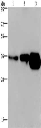 Gel: 8%SDS-PAGE, Lysate: 40 μg, Lane 1-3: Human breast infiltrative duct tissue, Human fetal brain tissue, mouse brain tissue, Primary antibody: CUEDC2 Antibody(CUEDC2 Antibody) at dilution 1/600, Secondary antibody: Goat anti rabbit IgG at 1/8000 dilution, Exposure time: 2 minutesRabbit anti-Human CUEDC2 Polyclonal Antibody