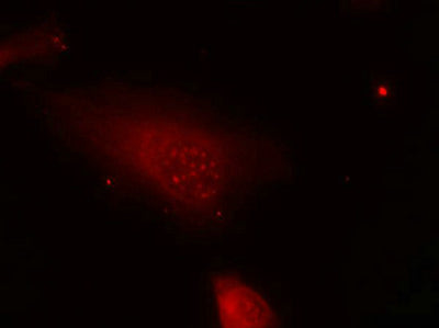 Immunofluorescence staining of methanol-fixed Hela cells using FKHR(Phospho-Ser319) Antibody.Rabbit anti-Human FOXO1 Polyclonal Antibody