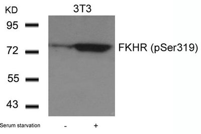 Western blot analysis of extracts from 3T3 cells untreated or treated with serum starvation using FKHR(Phospho-Ser319) Antibody.Rabbit anti-Human FOXO1 Polyclonal Antibody