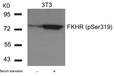 Western blot analysis of extracts from 3T3 cells untreated or treated with serum starvation using FKHR(Phospho-Ser319) Antibody.Rabbit anti-Human FOXO1 Polyclonal Antibody