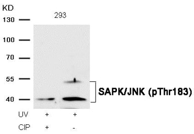 Western blot analysis of extracts from 293 cells, treated with UV or calf intestinal phosphatase (CIP), using SAPK/JNK (Phospho-Thr183) Antibody.
