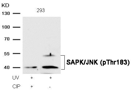 Western blot analysis of extracts from 293 cells, treated with UV or calf intestinal phosphatase (CIP), using SAPK/JNK (Phospho-Thr183) Antibody.