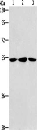 Gel: 8%SDS-PAGE, Lysate: 40 μg, Lane 1-3: Human fetal liver tissue, hela cells, Human fetal brain tissue, Primary antibody: ALDH9A1 Antibody(ALDH9A1 Antibody) at dilution 1/240, Secondary antibody: Goat anti rabbit IgG at 1/8000 dilution, Exposure time: 30 secondsRabbit anti-Human ALDH9A1 Polyclonal Antibody