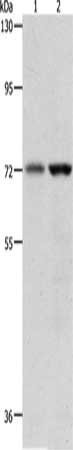Gel: 8%SDS-PAGE, Lysate: 40 μg, Lane 1-2: 293T cells, human fetal muscle tissue, Primary antibody: PGR Antibody(PGR Antibody) at dilution 1/600, Secondary antibody: Goat anti rabbit IgG at 1/8000 dilution, Exposure time: 10 secondsRabbit anti-Human PGR Polyclonal Antibody