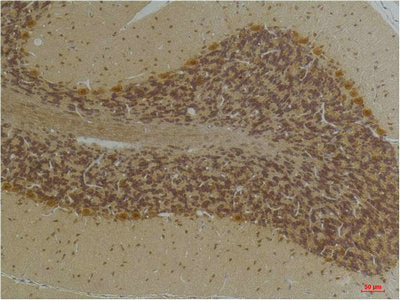 Immunohistochemical analysis of paraffin-embedded Human BrainTissue using KCNN2(SK2) Rabbit pAb diluted at 1:200.