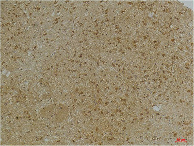 Immunohistochemical analysis of paraffin-embedded Mouse BrainTissue using KCNN2(SK2) Rabbit pAb diluted at 1:200.