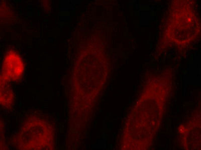 Immunofluorescence staining of methanol-fixed Hela cells using eIF2a(Phospho-Ser51) Antibody.Rabbit anti-Human EIF2S1 Polyclonal Antibody