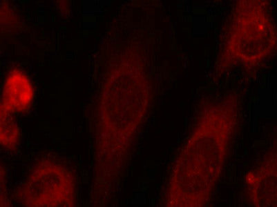 Immunofluorescence staining of methanol-fixed Hela cells using eIF2a(Phospho-Ser51) Antibody.Rabbit anti-Human EIF2S1 Polyclonal Antibody