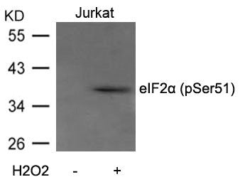 Western blot analysis of extracts from Jurkat cells untreated or treated with H2O2 using eIF2a(Phospho-Ser51) Antibody.Rabbit anti-Human EIF2S1 Polyclonal Antibody