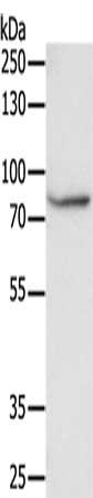 Gel: 8%SDS-PAGE, Lysate: 40μg, Lane: Human fetal muscle tissue, Primary antibody: F13A1 Antibody(F13A1 Antibody) at dilution 1/250, Secondary antibody: Goat anti rabbit IgG at 1/8000 dilution, Exposure time: 30 minutesRabbit anti-Human F13A1 Polyclonal Antibody