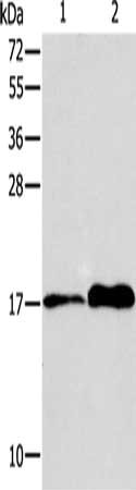Gel: 15%SDS-PAGE, Lysate: 40 μg, Lane 1-2: MCF7 cells, human colon tissue, Primary antibody: AGR3 Antibody(AGR3 Antibody) at dilution 1/150, Secondary antibody: Goat anti rabbit IgG at 1/8000 dilution, Exposure time: 20 seconds